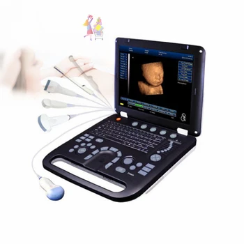 Медицинские ультразвуковые инструменты 3D 4D, полноцифровая цветная доплеровская ультразвуковая диагностическая система